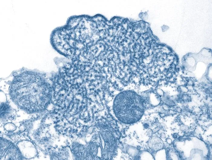 Vírus Nipah