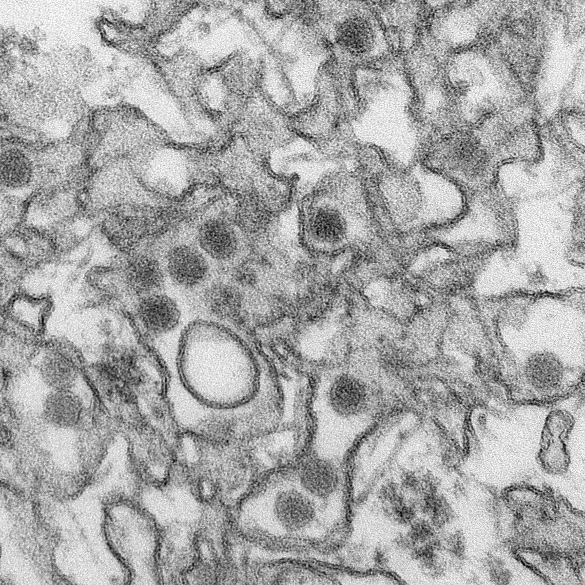 zika