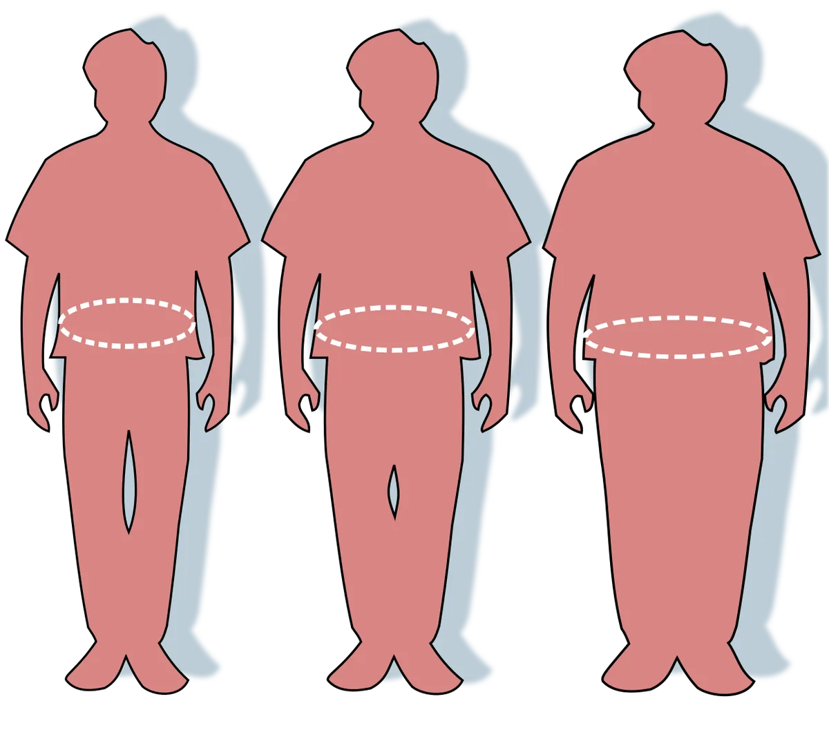 Associação Brasileira para Estudo da Obesidade